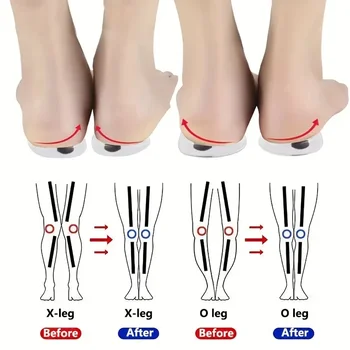 1 чифт ортопедични стелки за корекция на вальгусной деформация на стъпалата O / X вида за мъже и жени, Стелки за обувки от силиконов гел, Магнитни масажни възглавнички за обувки